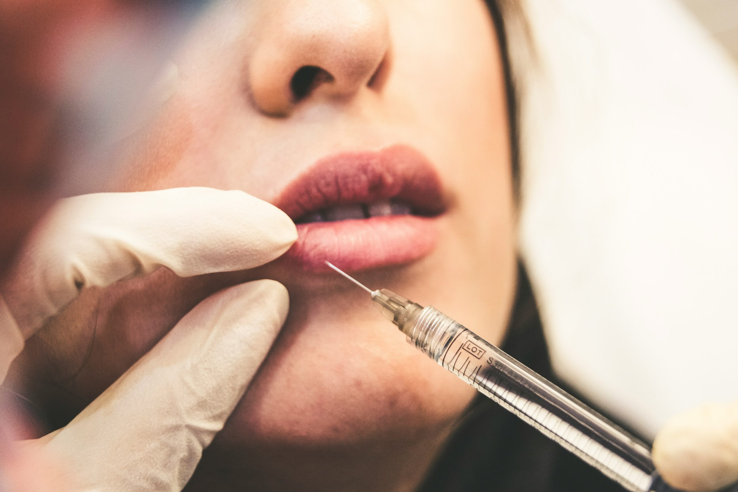 Wat past bij jouw huid: injectables of fillers?